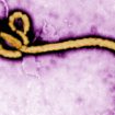 150203163641-ebola-virus-virion-outbreak2-super-169