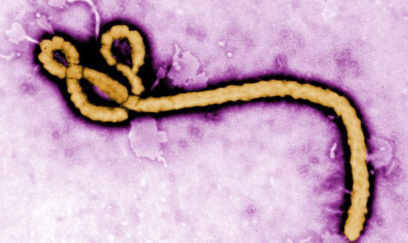 150203163641-ebola-virus-virion-outbreak2-super-169